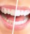 blanqueador-pulidor-de-dientes-luma-smile-quita-manchas-aa-D_NQ_NP_720705-MCO25072977934_092016-F
